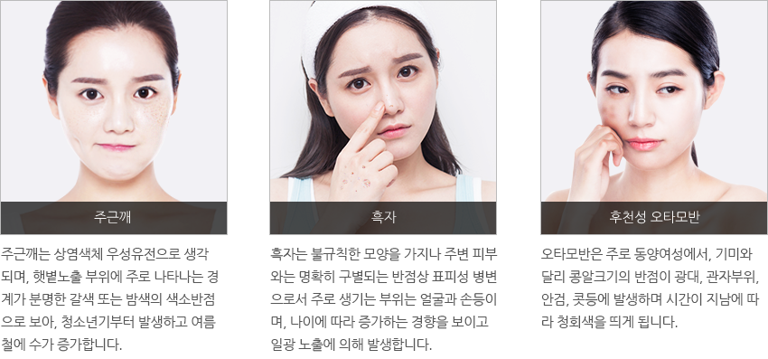 아꼴레이드