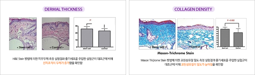 아기주사의 원리